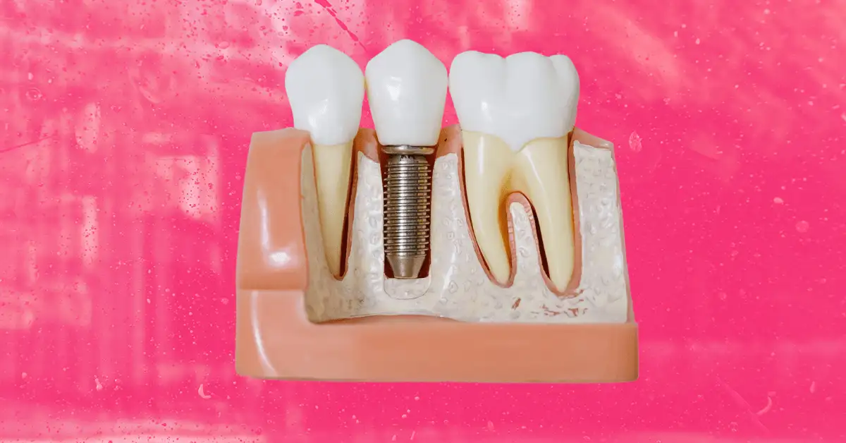 Dentists are getting high-tech
